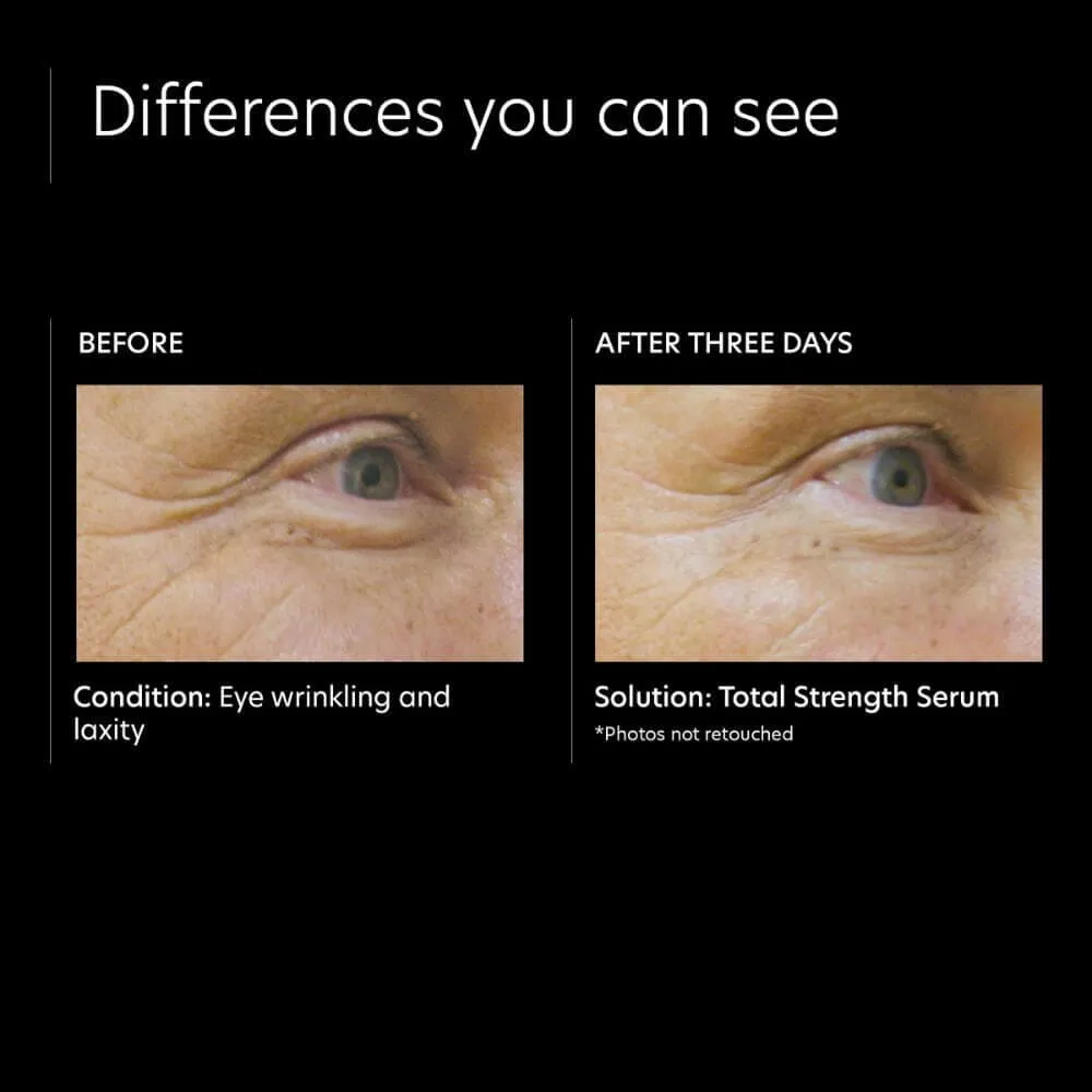 PCA Skin Total Strength Serum
