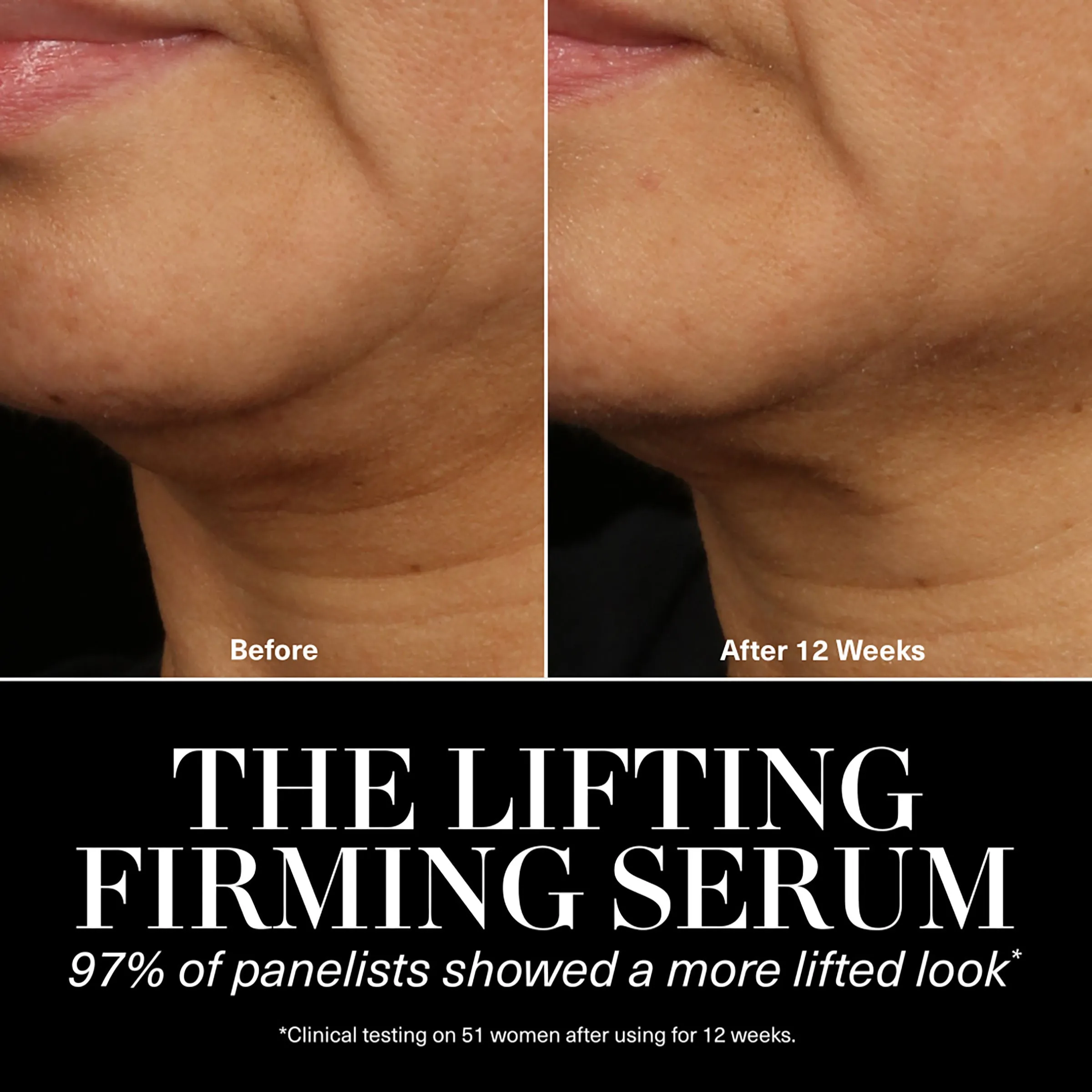 The Lifting Firming Serum